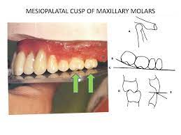 Maybe you would like to learn more about one of these? Ppt Setting Of Posterior Teeth Powerpoint Presentation Free Download Id 2497279