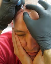 Without much forethought, i injected scrotox into a long list of more. I Botoxed My Balls To Make Them Look Nicer