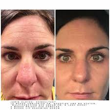 Sarah Burch- R+F Independent Consultant
