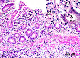 Image result for Balantoides Coli