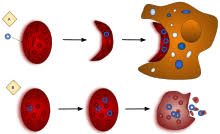 Sickle cell disease, a genetic disorder that affects red blood cells, is found most often in african americans and hispanics, but can be found in other ethnic groups. Sickle Cell Disease Wikipedia