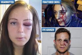 Cops left with fractured skulls and gouged eyes after being battered