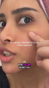 What should I do? 😭 HELP 😱, I do NOT recommend under eye filler, even  thought it was magical when I first got it. It can migrate, even make you  blind if injected improperly, and can impacts your ...