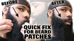 Maybe you would like to learn more about one of these? Quick Fix For A Patchy Beard Growing A Thick Mustache For No Shave November Youtube