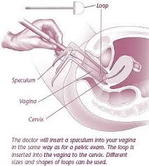 Leep Chicago Urogynecology