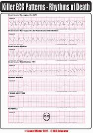 Pin By Carine Coetzee On Medical Emergency Nursing Cardiac Nursing Nurse