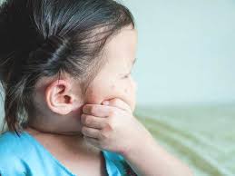 Image result for Papular urticaria