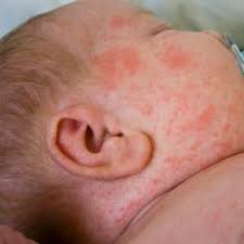 Hsv i and hsv ii. Std Guides Stdguides Profile Pinterest