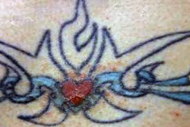 Check spelling or type a new query. Tattoos 7 Unexpected Skin Reactions And What To Do About Them