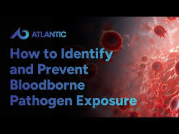 Image result for Bloodborne Pathogen Exposure