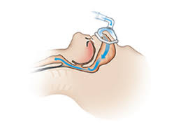 Before we can understand what a cpap machine is and how it works, we need to understand what it is used for, and that is sleep apnea. How Cpap Therapy Works Fpm Solutions Cpap Medical Devices