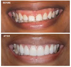 Dentists manage our oral health, from making recommendations for achieving the best oral hygiene to diagnosing and treating issues with our teeth and gums. The Must Have Equipment For Cosmetic Dentists