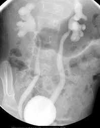 Is your child due for a vcug? Gallery X Ray Radiography Equipment Procedure Photograph 394