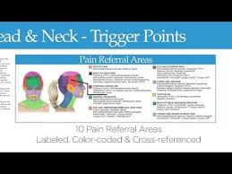 Trigger Point Charts 5 Chart Set Beauty Health Trigger