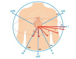 12 Lead Ecg Placement Guide With Illustrations