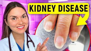 Edward Humbert's Instagram, Twitter & Facebook