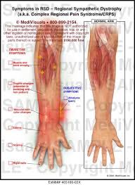 Pin On Crps