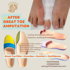 Image result for toe amputation