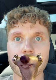 Connor Phillips Missing Tooth