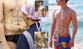Grisha mamurin pays girls to flash their breast's and then posts the video's online. Man From Thailand Undergoes Bizarre Liposuction Procedure To Get Six Pack Abs Daily Mail Online