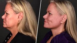 Dylan and husband Brian share update