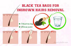 Use a tablespoon of small cubed sugar and mix it with 1 tablespoon of olive oil. 11 Remedies For Get Rid Of Ingrown Hair Ideas Ingrown Hair Ingrown Hair Remedies Hair Remedies