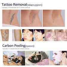 Does tattoo removal actually work? Top Quality New Technology Victory Nd Yag Laser Tattoo Removal Machine Buy Nd Yag Long Pulse Laser Vascular Qswitch Laser Tattoo Removal Nd Yag Laser Tattoo Removal Product On Alibaba Com