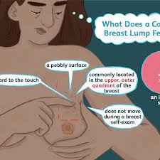 Breast Lumps Cancerous Vs Noncancerous