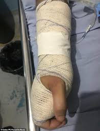 بالصور رجل يحول جسد زوجته إلى لحم فاسد بالتعذيب