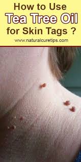 Awaken Yourself About The 7 Tea Tree Oil Benefits Tea Tree Do It Yourself Recipes How To In 2020 Tea Tree Oil Benefits Tea Tree Oil For Acne Skin Tags Essential Oils