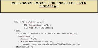 Image result for MELD Score