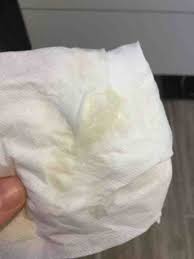 Maybe you would like to learn more about one of these? Does This Look Like My Mucus Plug 39weeks 1