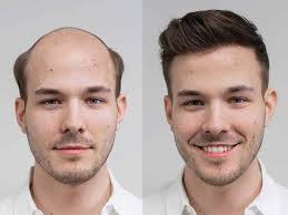 He had many high points as the manager of the hammers, including their famous first. David Beckham Hair The Secret Of The World S Most Aesthetic Man
