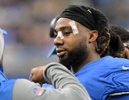Detroit Lions notes: Chris Houston's injury a concern