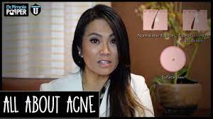 Dr sandra lee's videos are revolting, but we just can't look away. All About Acne With Dr Sandra Lee Youtube