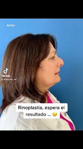 Evelyn de la Cruz. 👩🏻‍⚕️Otorrino (@dra.eve_orl) · Instagram 照片和视频