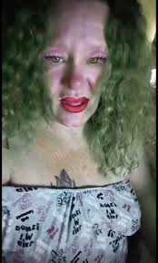 A bruise that looks like a creepy clown.