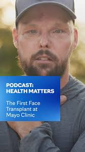 The first face transplant was performed in 2005. Since then, only about 50  face transplants have been done in the entire world. It’s a complex surgery  that requires all the expertise a surgeon can ...