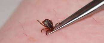 Show me a picture of a tick. Tick Removal Barnstable County Department Of Health And Environment