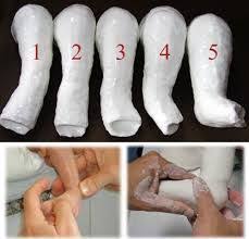 With early treatment, the condition known as clubfoot can be corrected, and your child will be able to walk and run with the best of them. I Pinimg Com 600x315 26 2d 4f 262d4f2688f1690e6