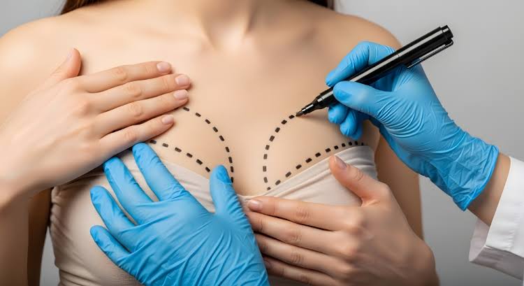 Breast Augmentation Consultation: Your First Step Toward Enhanced Confidence
