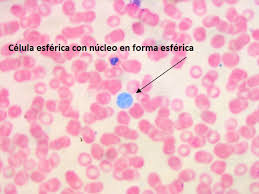 Esféricas u ovoides: Redondas u ovaladas, como los leucocitos y un cigoto.