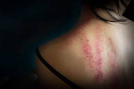 Seid gespannt auf ihr thema: Alle Zwei Tage Wird In Deutschland Eine Frau Vom Ex Partner Ermordet