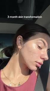 Taylor Olsen Before and After