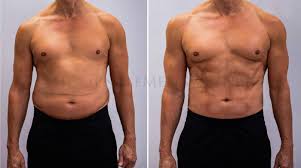 We did not find results for: Stoffwechsel Kur The Gentlemen S Clinic