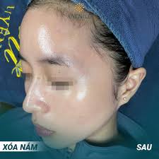 Thẩm mỹ Uyên Lee