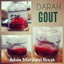 Gangguan jin dan makhluk halus. Pusat Rawatan Islam Darul Nusrah Tanda Gout Gout Lazimnya Menyerang Ibu Jari Kaki Ibu Jari Kaki Menjadi Merah Panas Bengkak Dan Tersangat Sakit Serangan Selalunya Berlaku Secara Tiba Tiba