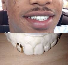 Premium gold plating open faced style dimensions: Pin On Gold Grills