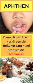 Seit über nem monat nimmt er täglich eine messerspitze ascorbinsäure. So Wirst Du Aphthen Schnell Wieder Los Aphthen Im Mund Aphten Im Mund Hausmittel Aphten Im Mund Kinder Aphten Auf Der Zunge Aphten H Remedies Health Vegan