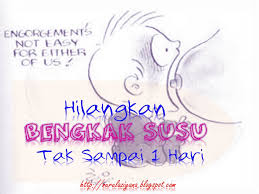Kamu bisa mengompres mata bengkak dengan susu. Hilangkan Bengkak Susu Tak Sampai 1 Hari Story Of Health Beauty